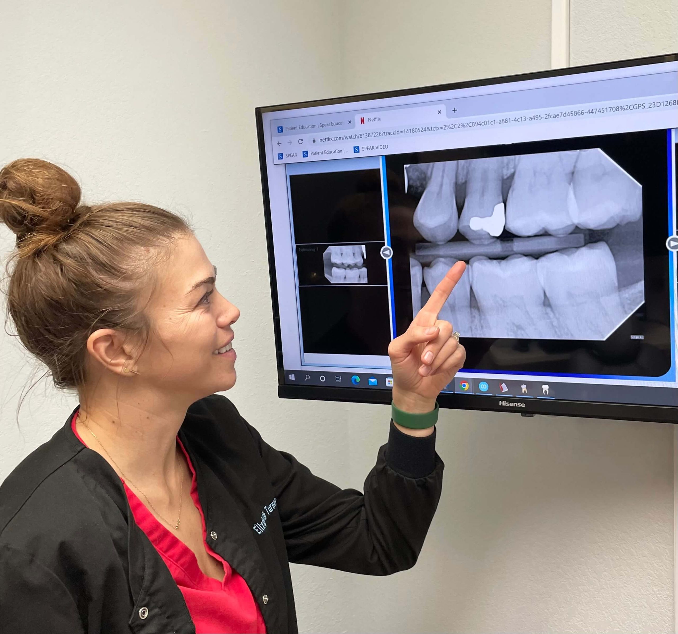 Digital Cavity Detecting Radiology In Lakewood CO
